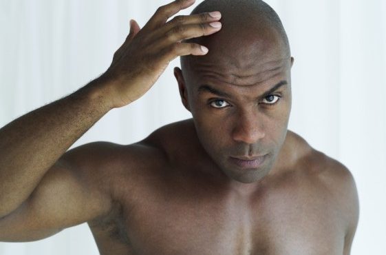 Bald young men at higher risk of heart disease | TheCable.ng
