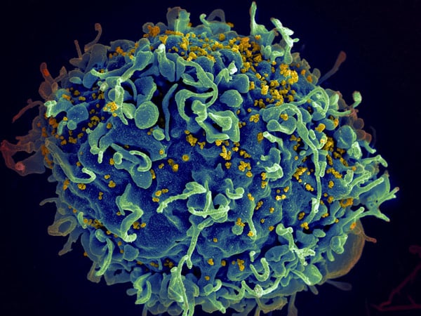 HIV AIDS | TheCable.ng