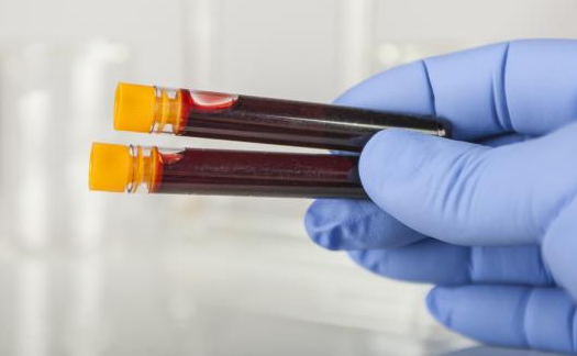 Scientists develop blood test ‘that can detect early-stage cancer’