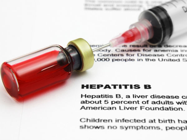 Hepatitis B more infectious than HIV, expert warns