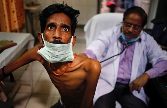 India launches vaccine trial to prevent tuberculosis