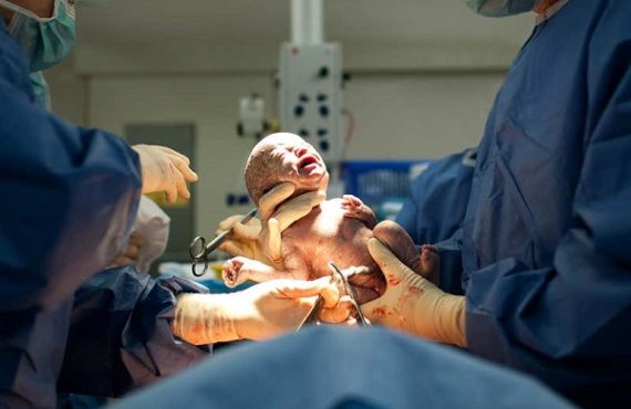 Study: Why C-section babies are at risk of certain diseases