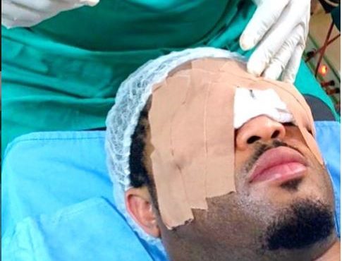 'Over 8 hours, I was without sight' — Mike Ezuruonye speaks after eye surgery