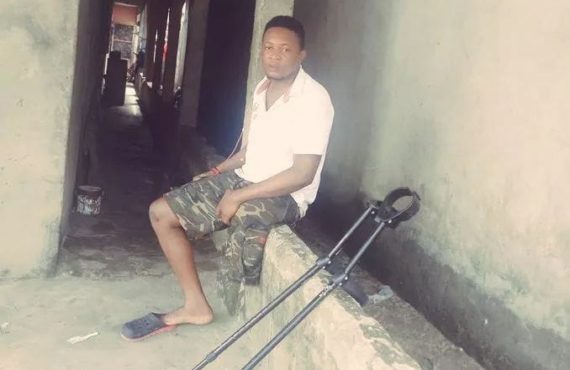 Student files N1b lawsuit against army over 'shooting, amputation of leg'