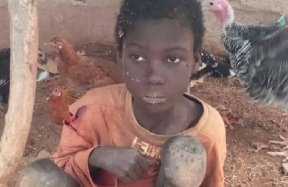 Police arrest father, stepmothers who 'chained boy for two years'