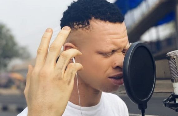 SPOTLIGHT: YellowCee, Nigeria's 'first albino rapper' likened to Dagrin