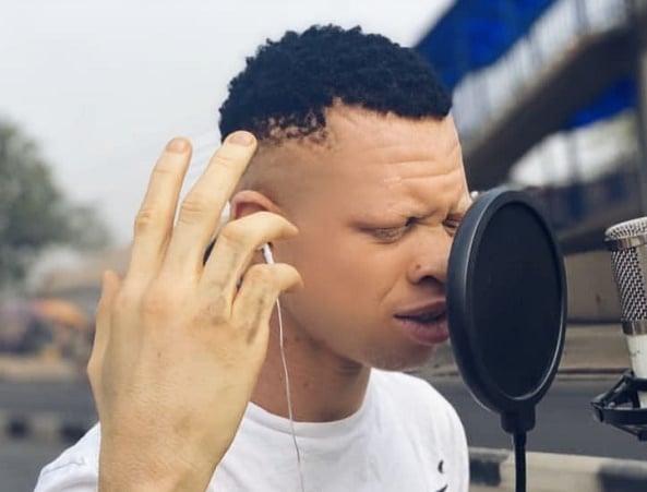 SPOTLIGHT: YellowCee, Nigeria's 'first albino rapper' likened to Dagrin