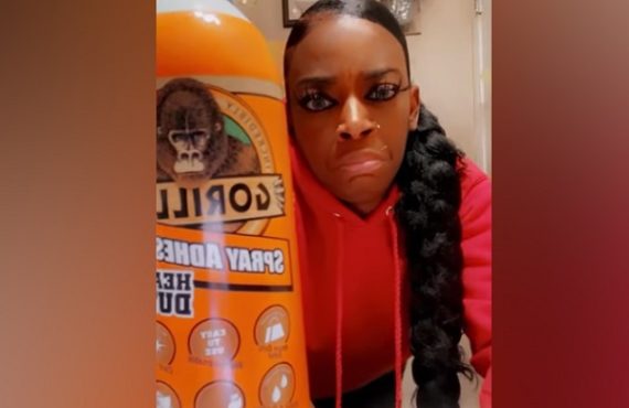 Woman undergoes surgery to remove gorilla glue from her hair
