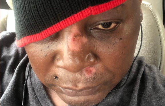 Charly Boy injured in scooter accident -- one month after quitting power bikes