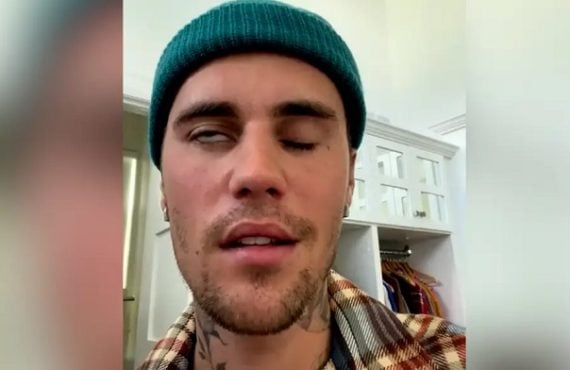 What to know about Ramsay Hunt syndrome -- the virus attacking Justin Bieber's face