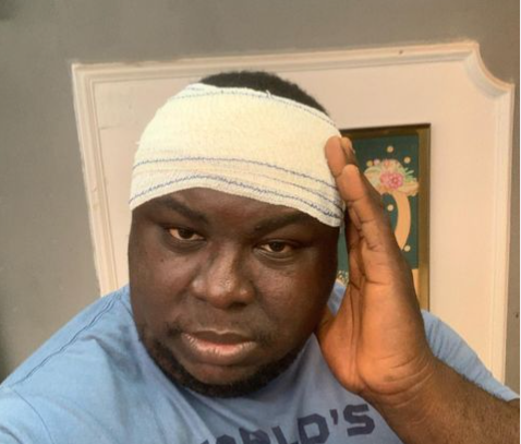 Emeka Okoye survives car accident, blames bad road