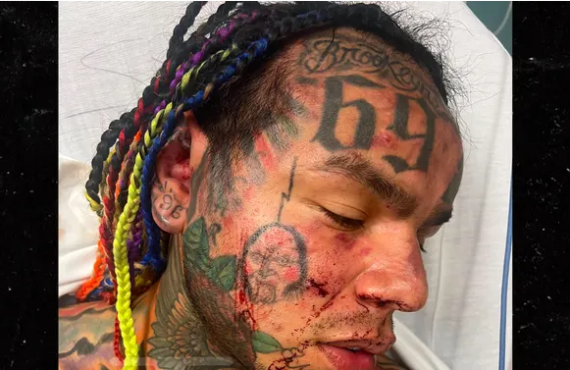 ICYMI: Rapper 6ix9ine hospitalised after attack at Florida gym