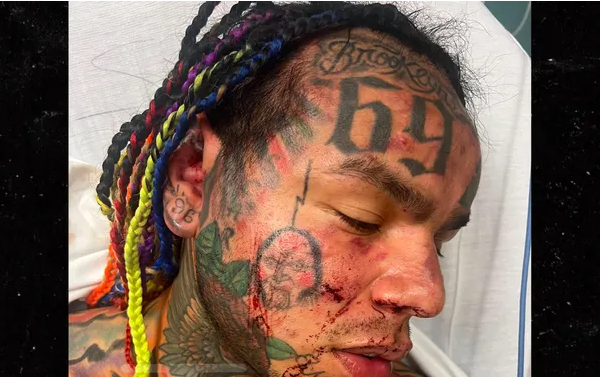 ICYMI: Rapper 6ix9ine hospitalised after attack at Florida gym